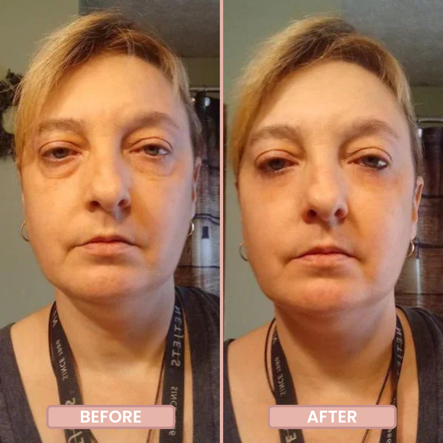 InstantFirm Eye Patches