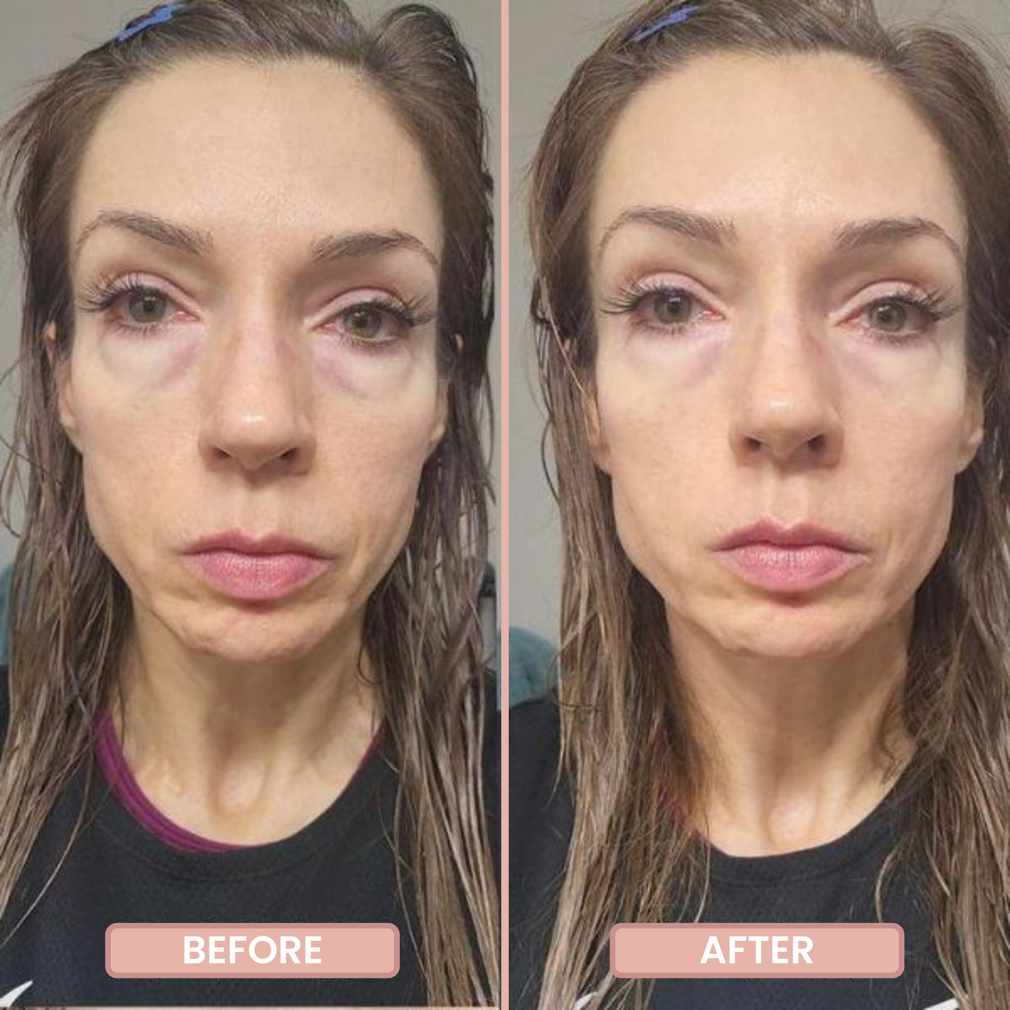 InstantFirm Eye Patches