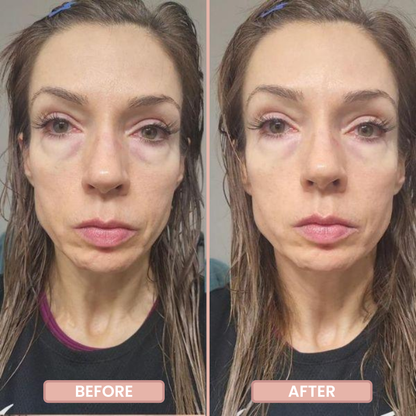 InstantFirm Eye Patches