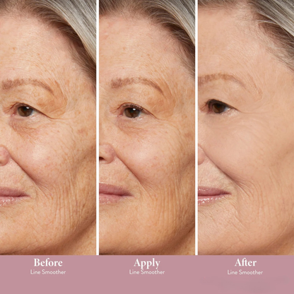 Auna Targeted Fine Line Filler
